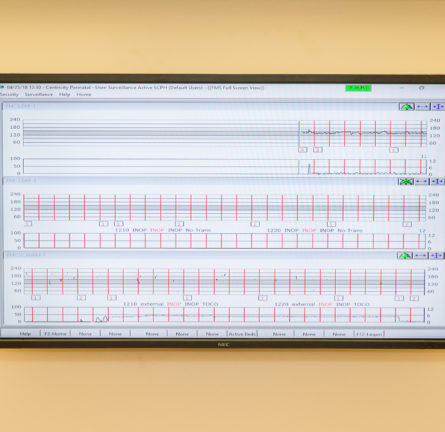 Central Monitoring System